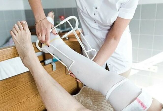 Pooperační období z chirurgického zákroku na žilách nohou